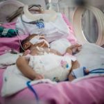 Early care essential in premature births Early care essential in premature births